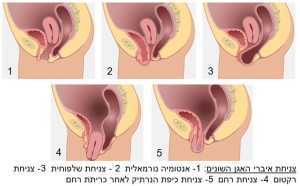 צניחת איברי האגו השונים
