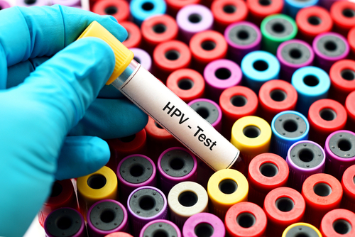 HPV-test בדיקות לאיתור סרטן צוואר הרחםן